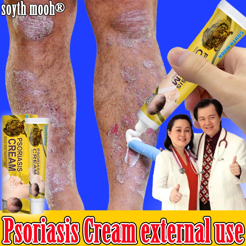 50g zudaifu cream eczema honey/anti eczema ointment cream psoriasis