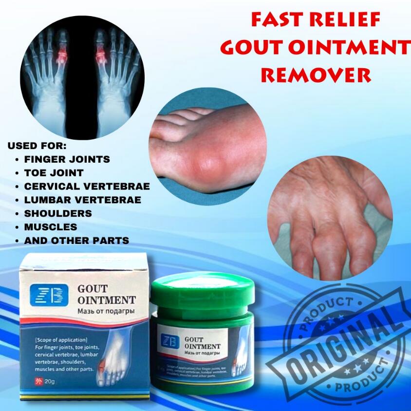 Gout Ointment Treatment Gout Cause Joint Knee Pain Toe Finger Bone Spur