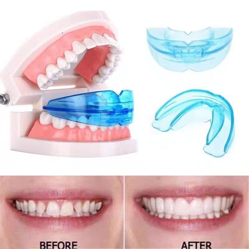 Teeth Alignment Retainer Dental Orthodontics | Shopee Philippines