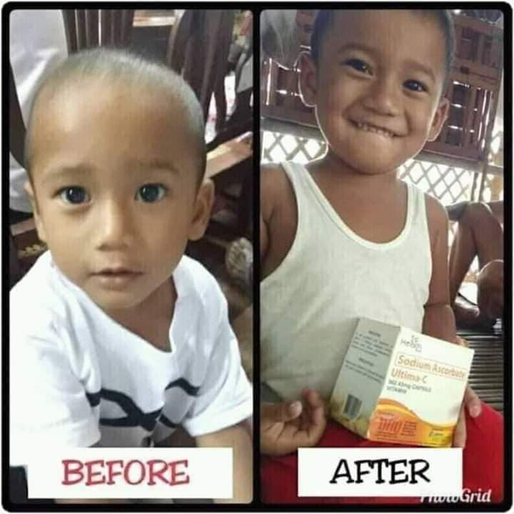 propan with iron Ultima c Original 30 Capsule Ultima C Vitamins Pampataba Ultima c Sodium Ascorbate