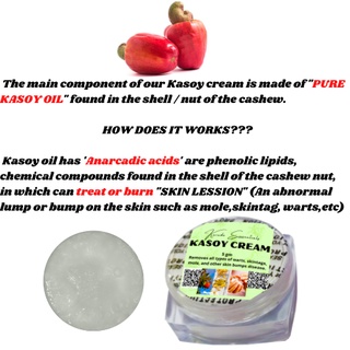 kasoy cream warts removal #2