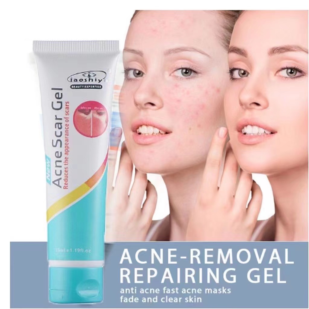 acne cream ginseng herbal pimple remover acne marks remover skin care