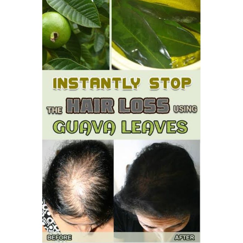 Guava leaves Dahon ng Bayabas Fresh or Air Dry 50g for hair loss remedy |  Shopee Philippines
