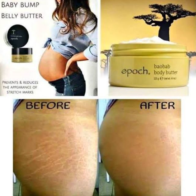 nu skin stretch mark cream