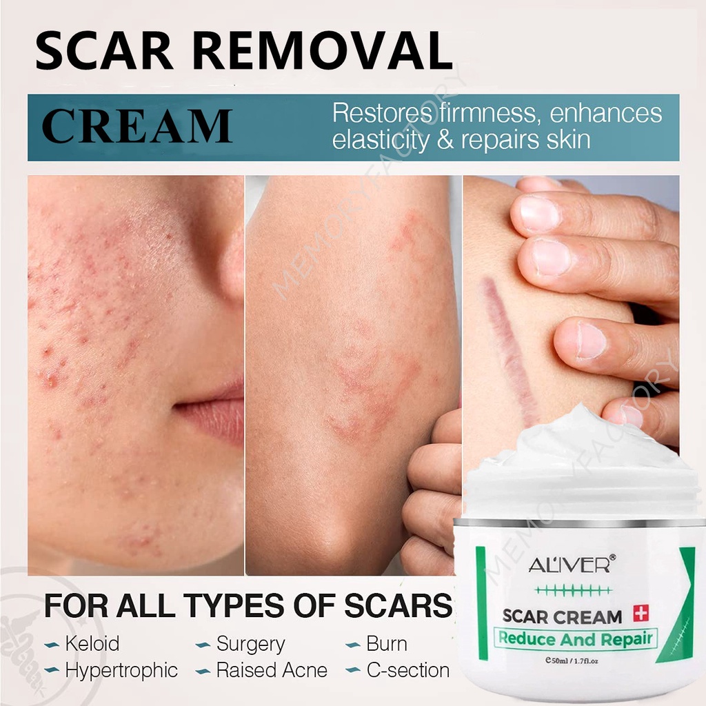 ALIVER Scar Remover Cream baby cream New Old Scars/acne marks, stretch