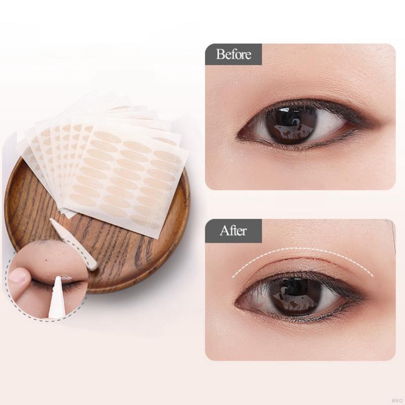 eyelid tape