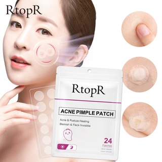 RtopR Acne Pimple Patch Invisible Acne Treatment Stickers Treatment Pimple Remover Tool Skin Care Waterproof 24 Patches Daily And Night Use #5