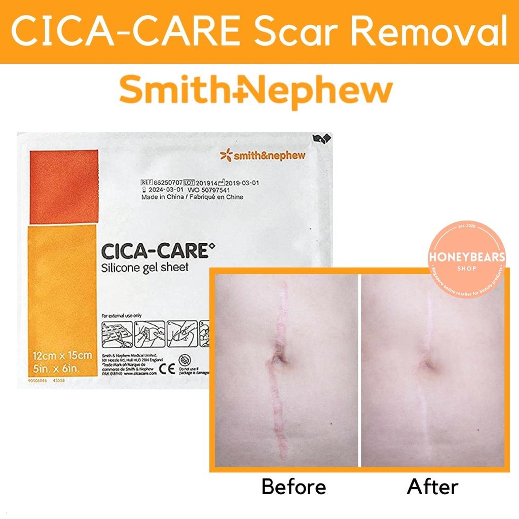 Malaysia CICACARE SelfAdhesive Silicone Gel Sheet Hypertrophic