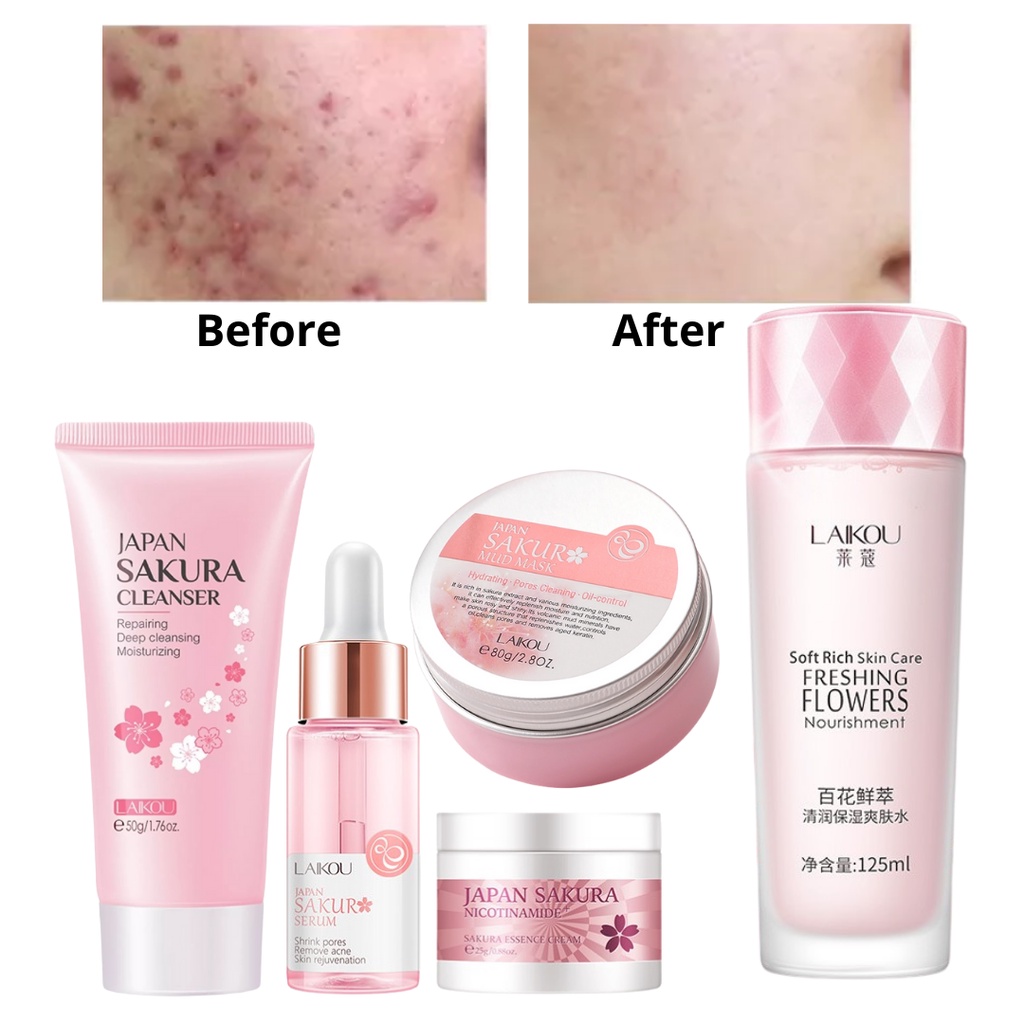 Japan Sakura Skin Care Set Whitening Set Exfoliating Shrink pores Acne and Pimple Treatment