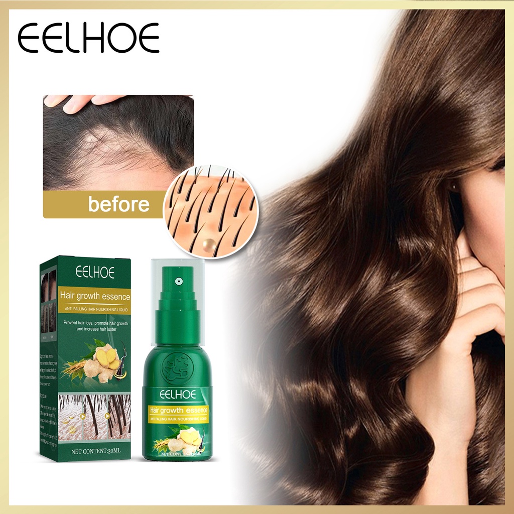 EELHOE 30ml Hair Growth Spray Ginger Anti Hair Loss Essential Oil ...