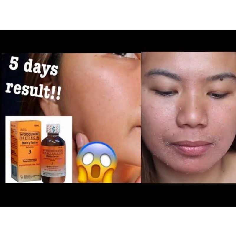 RDL Solution 1 2 3 original Shopee Philippines