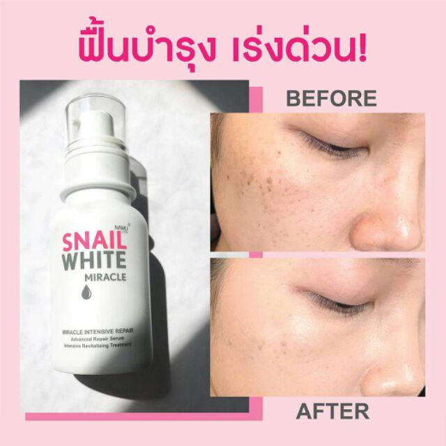 snail white miracle review
