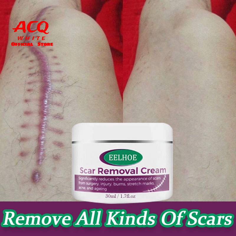 Effectively Scar Remove New Old Scars on Legs Face Body Scar Remove