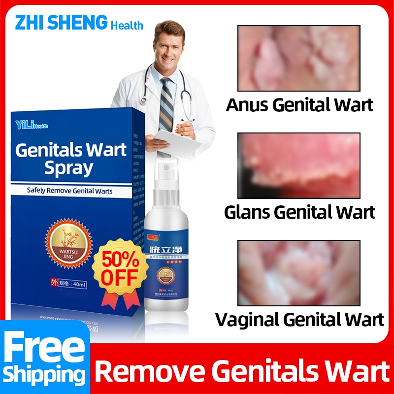 Genital Warts Removal Spray Treatment Condyloma Anus Warts Male Penis Warts Hpv Female Private 