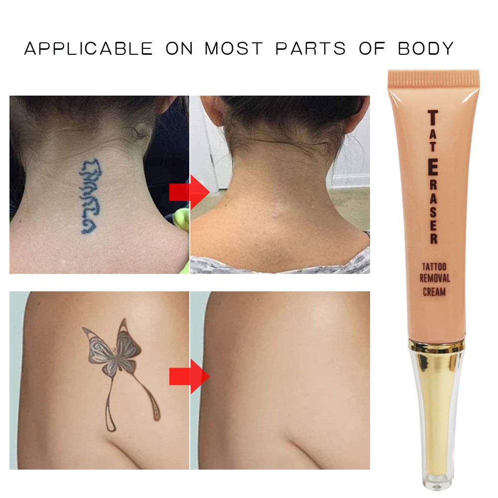 BOROLINE Permanent Tattoo Removal Cream Painless Eyebrows Remove Tattoos,No  Skin Damage,No Corrosion | Shopee Philippines