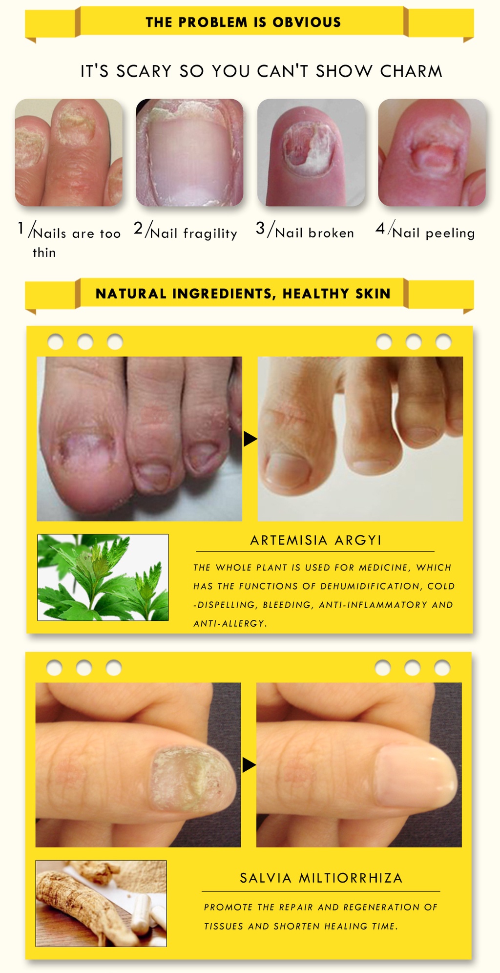 OEDO Ginseng Nail Antifungal Treatments Cream Removal Nail Fungus Toe ...