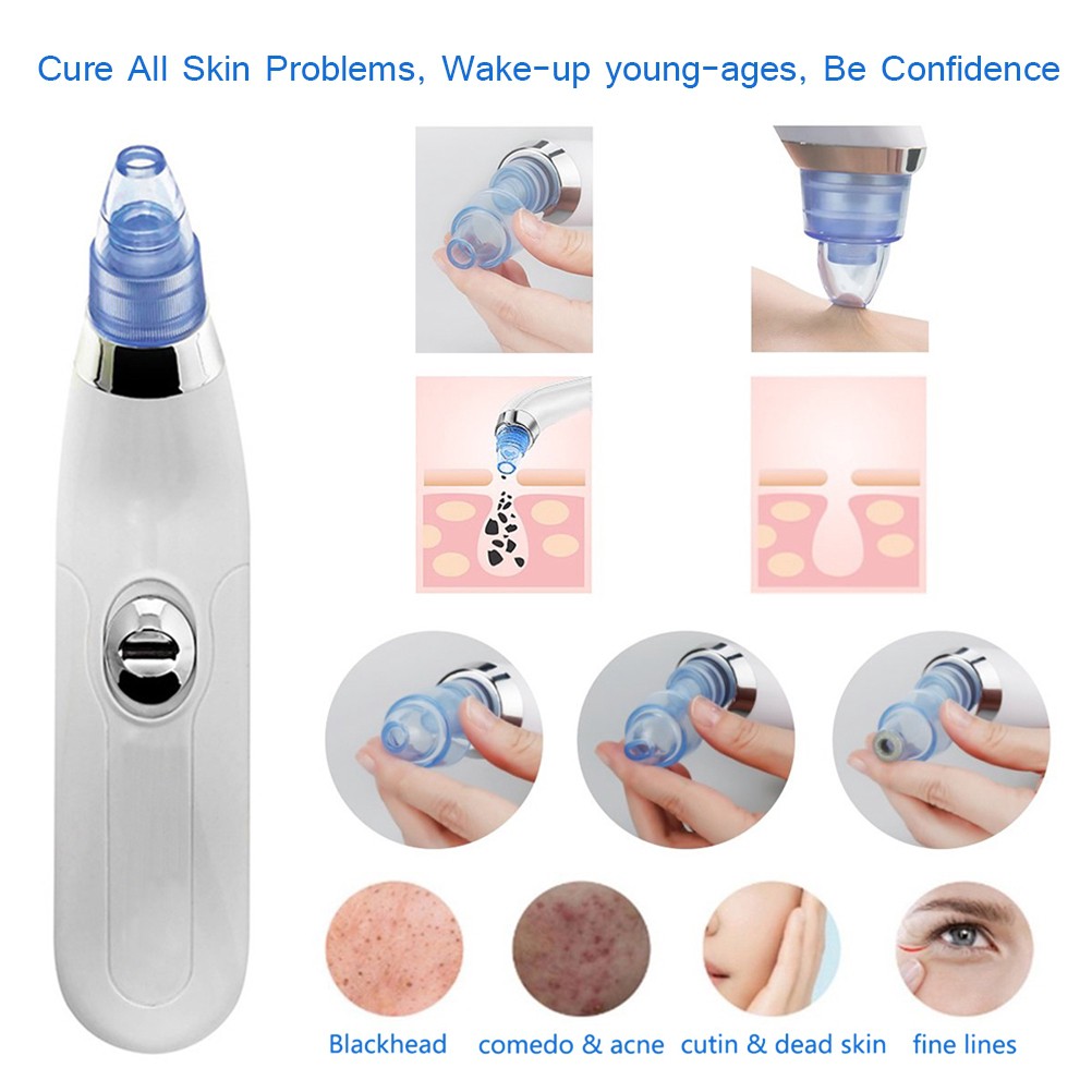 electric blackhead cleaner