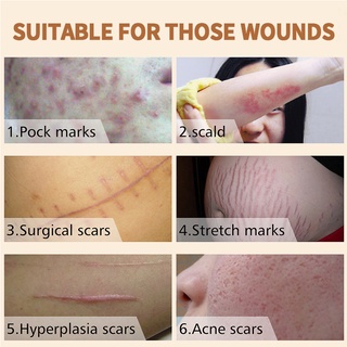 HEMEIEL Magic Scar Remover Gel Original/Scar removal for old scars #3