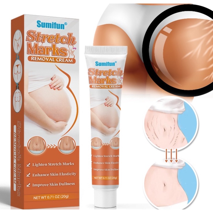 Stretch mark repair cream removes scars improves dull skin ointment pregnant women skin repair care fatty streaks