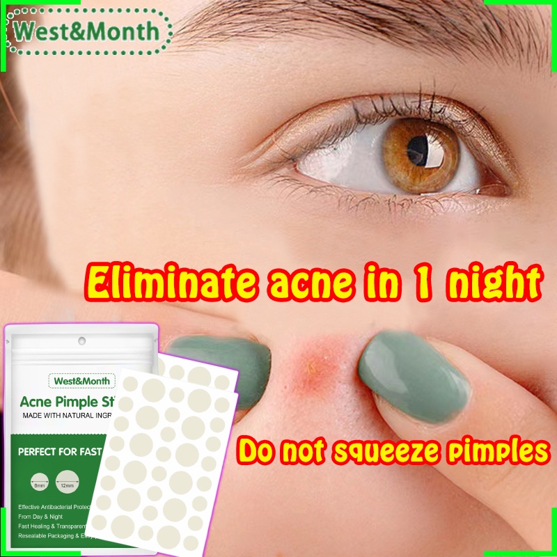 Pimple spot treatment sticker/luxe organix pimple patch/remove pimples