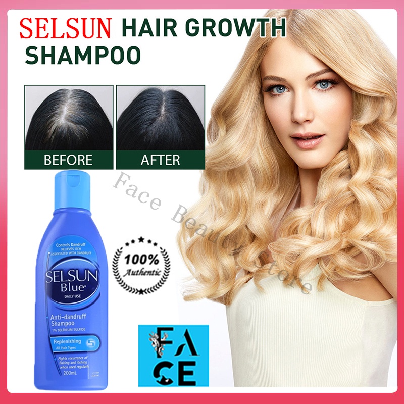 Selsun Blue Medicated Shampoo Treatment Anti Dandruff Seborrheic 