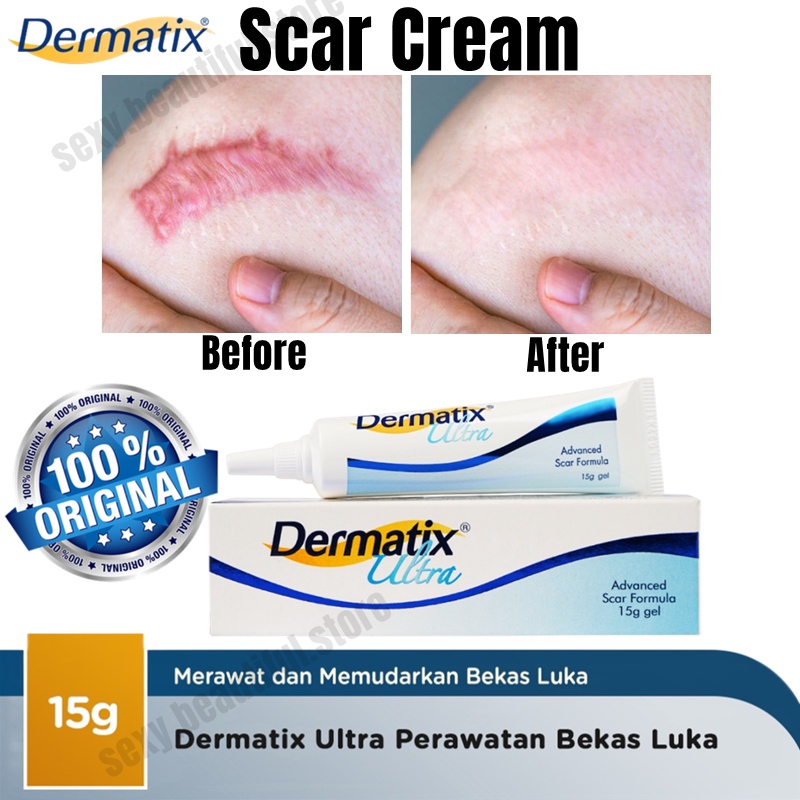 Original Dermatix Effective Scar Removal Cream Scar Gel Old Scars Acne ...