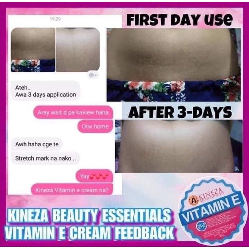 kineza vitamin e cream