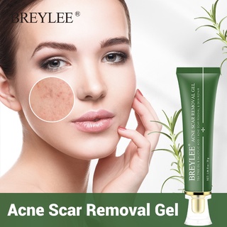 Low price activity Breylee Acne Treatment Set 6 pcs (facial cleanser,acne scars removal gel ,serum , #3