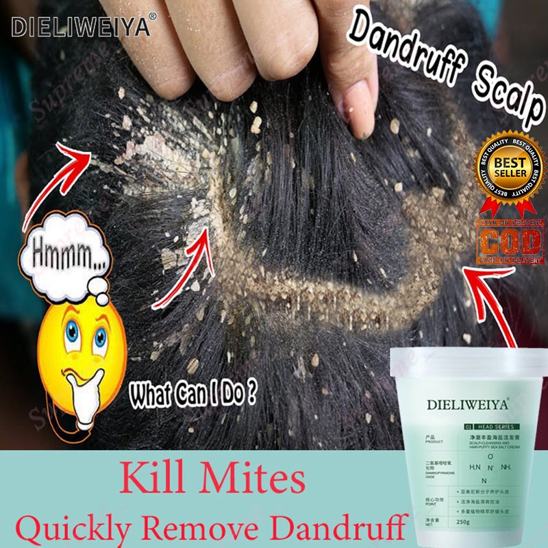 anti dandruff hair treatment DIELIWEIYA Sea Salt Anti Dandruff Shampoo Hair  Treatment Shampoo For Sc | Shopee Philippines