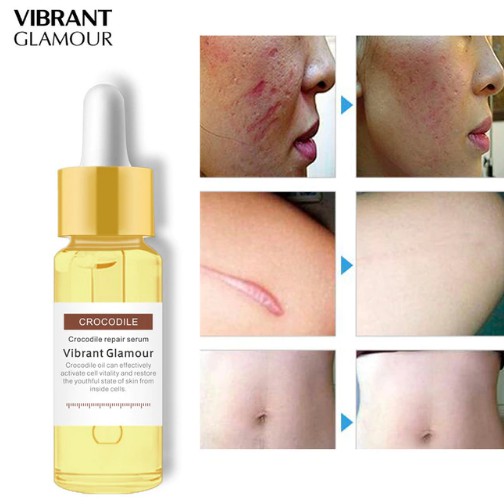 face serum for acne marks