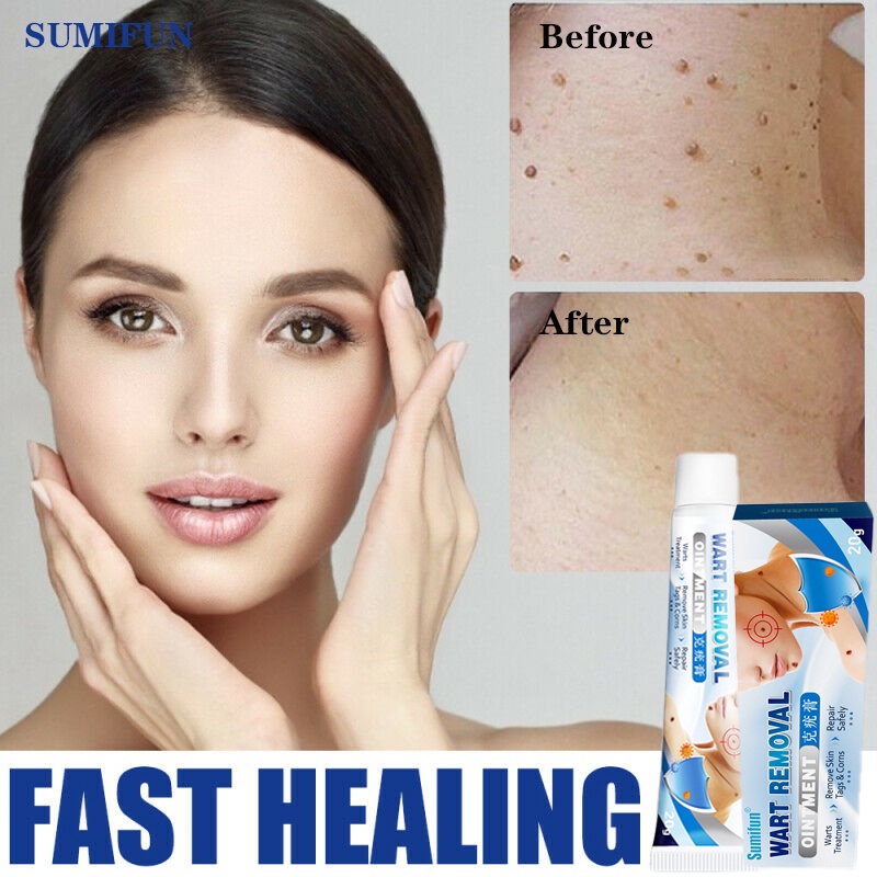 SUMIFUN Warts Remover Original Cream Wart Remover Ointment Warts And ...