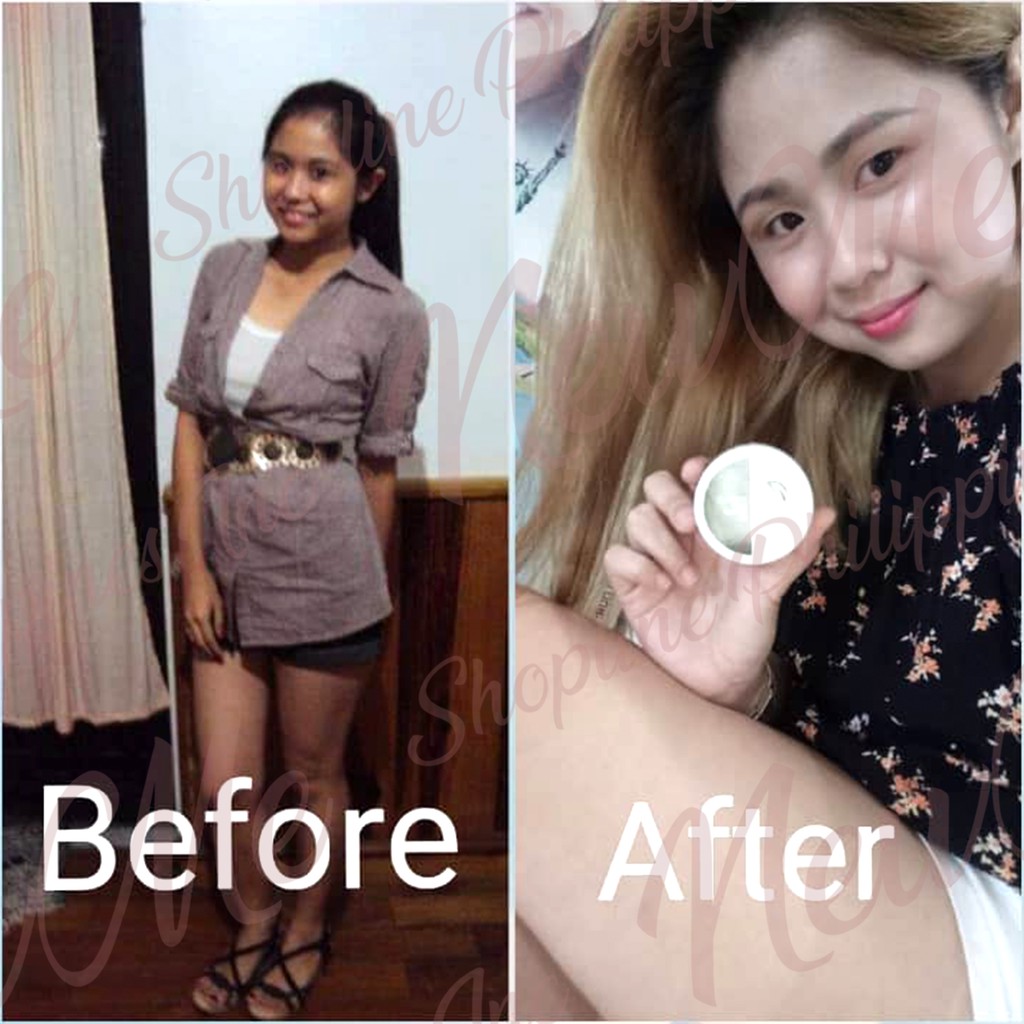 miracle cream watson