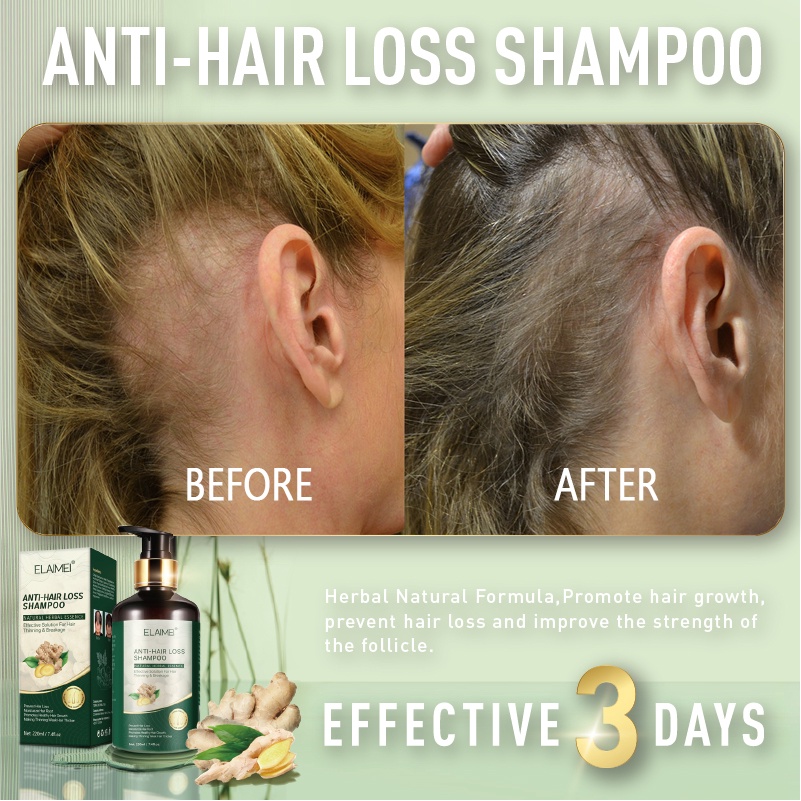 ginger shampoo pampahaba ng buhok mabilis ginger hair growth shampoo