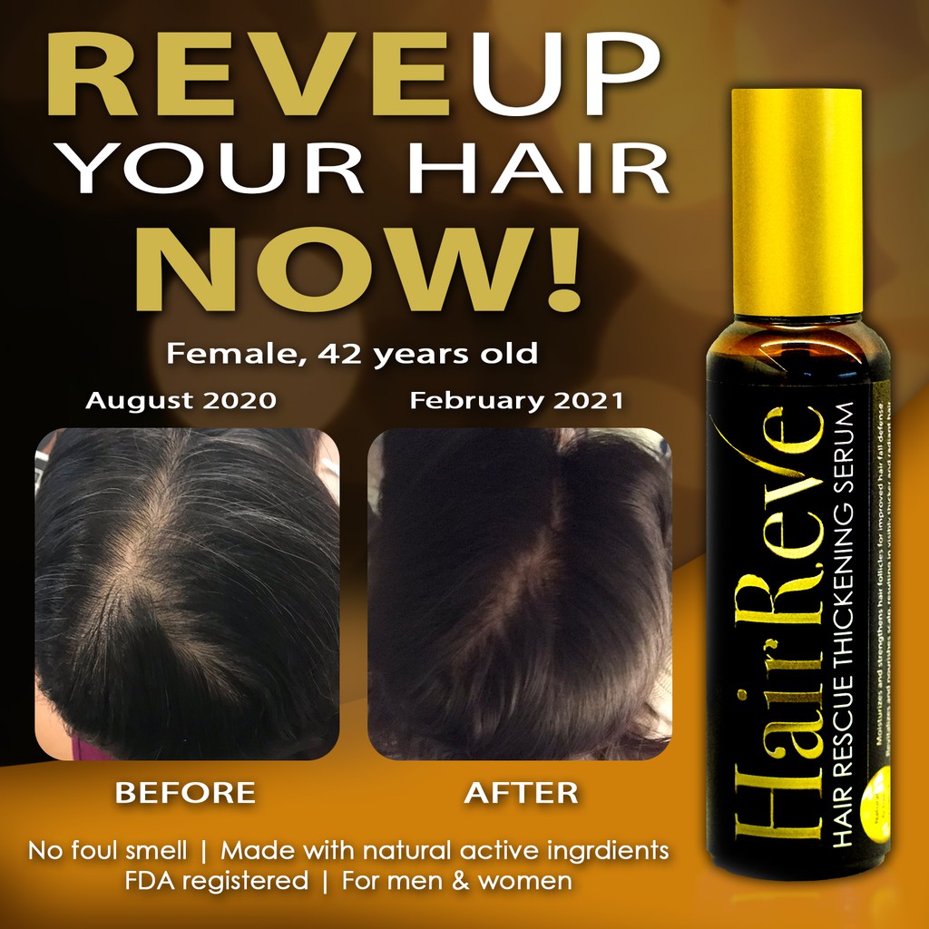 HairReve Hair Rescue Thickening Serum (Expiry 11/2023) Shopee Philippines