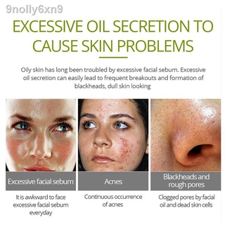 【Factory price】▧VIBRANT GLAMOUR Tea Tree Oil Acne Pimples Scars Treatment Facial Toner 30ml #6