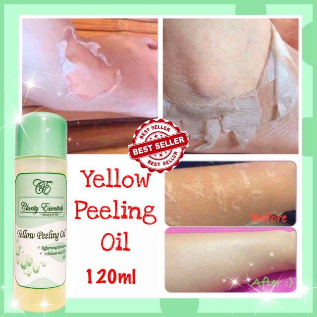 peeling lotion yellow