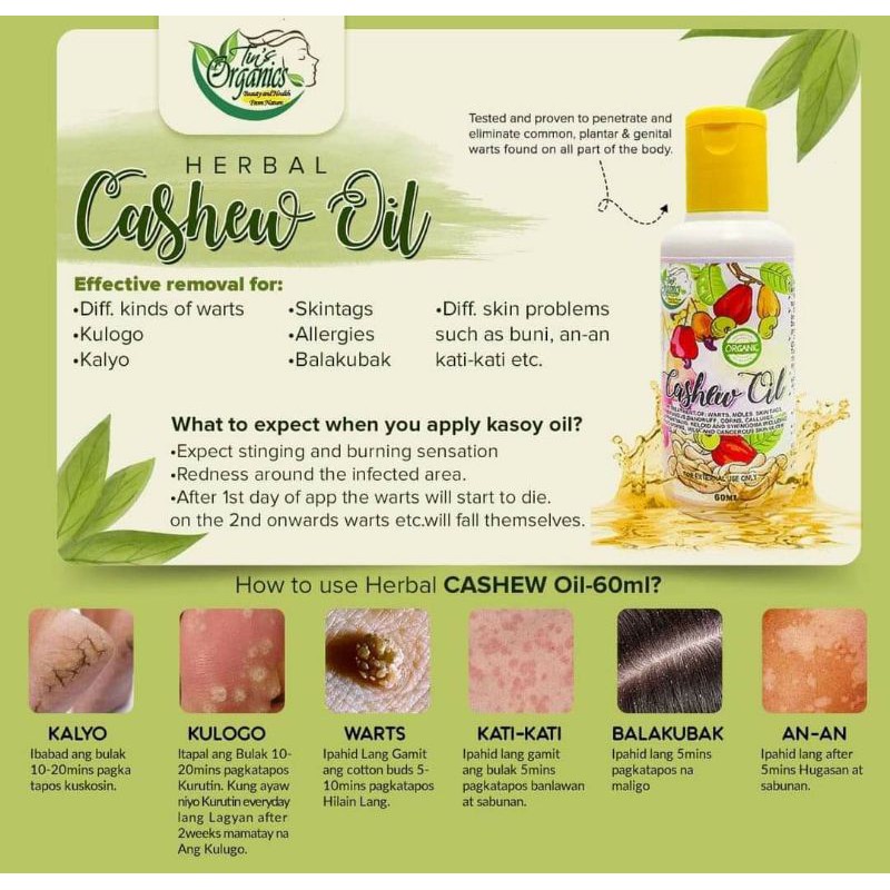 ANTIWARTS (CASHEW OIL) Shopee Philippines