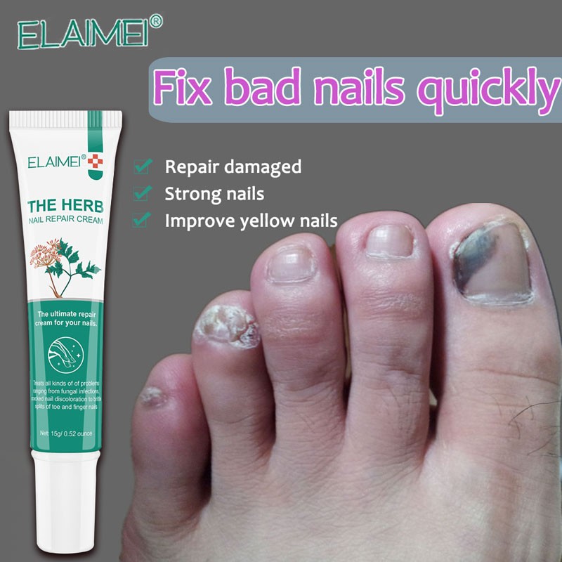 The Best Treatment For Brittle And Damaged Nails: Mavala Nailactan! | Efero  Nail Therapy Repair Gel Restore Fragile Yellow Nails Damaged Nails |  