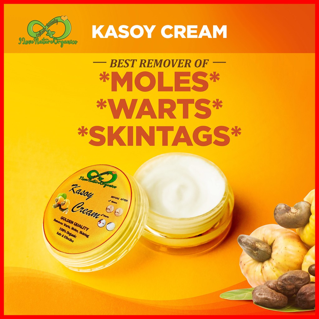 Kasoy Cream Mole Remover, Warts Remover, Skin Tag