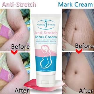 Remove Stretch Marks Cream Anti Wrinkle Anti Aging Maternity Skin Repair Remove Pregnancy Scars