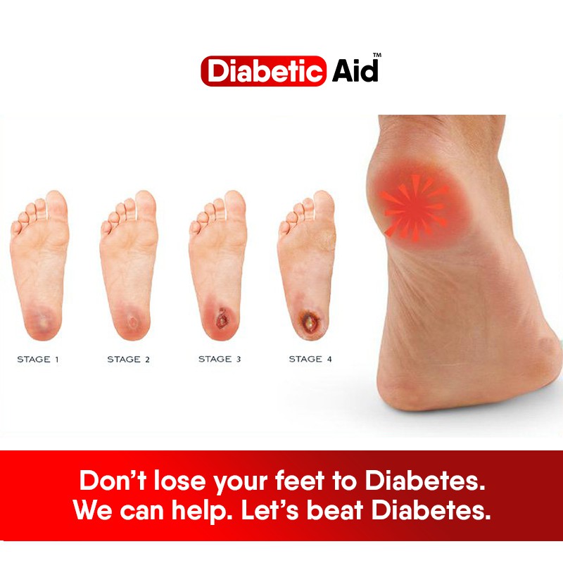Diabetic Aid Foot Cream Shopee Philippines