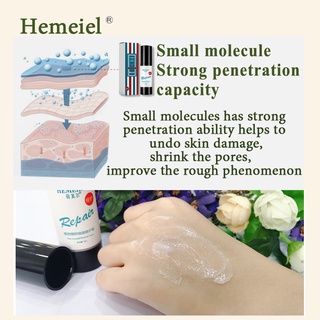 HEMEIEL Magic Scar Remover Gel Original/Leave no trace/Deep Scar Removal #7