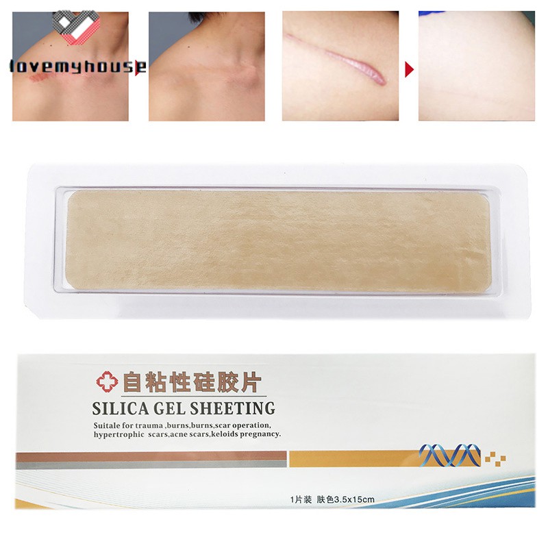 silastic sheeting for scars