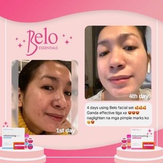 Belo Facial Set (Rejuv and Whitening Skincare Set) | Shopee Philippines