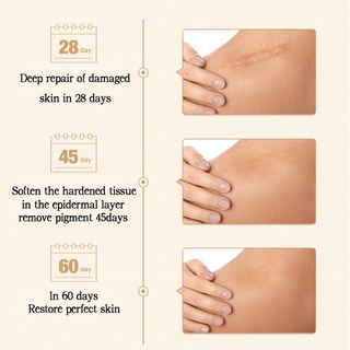 HEMEIEL Magic Scar Remover Gel Original/Leave no trace/Deep Scar Removal #6
