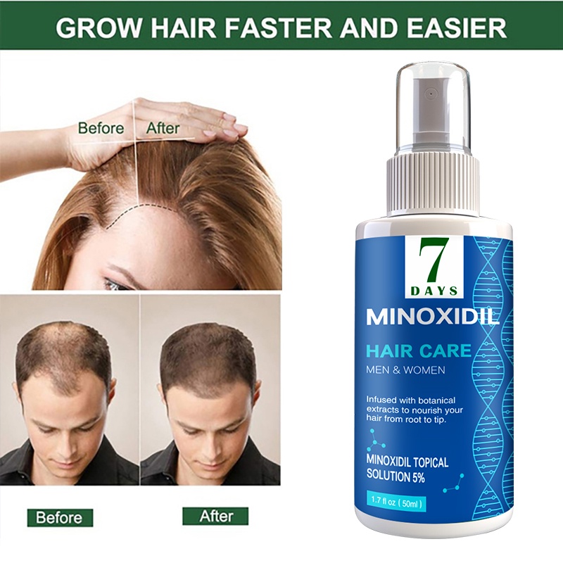 30ml Hair Growth Spray Ginger Hair Grow Hair essential oil Treatment  Preventing Hair Loss Spray hair-restorer | Shopee Philippines