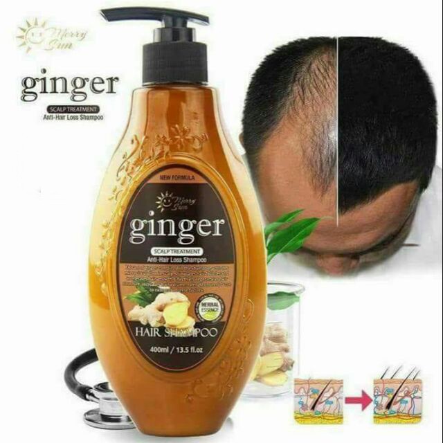 Merry Sun Ginger Scalp Treatment AntiHair Loss Shampoo 400ml Shopee