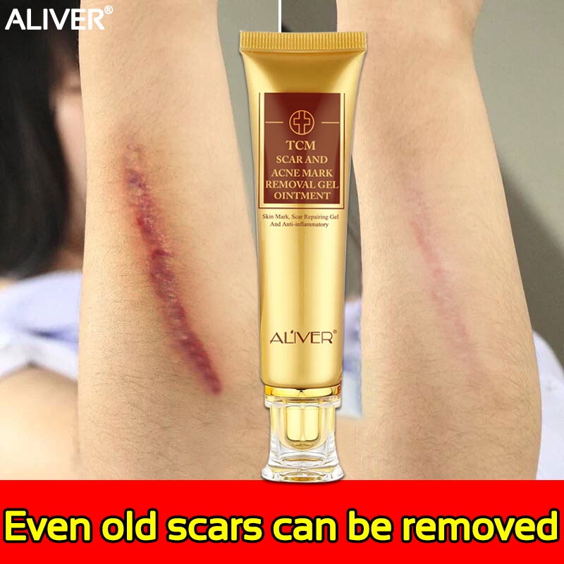 Scar remove cream gel removes various of scars(scar removal scar