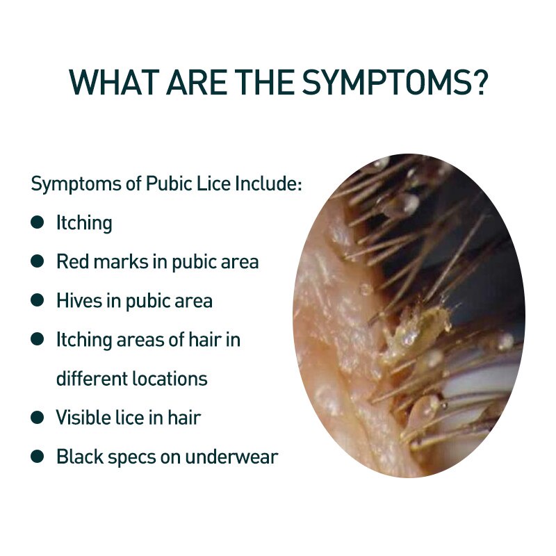 Sl Chang 1box 20g Mite Removal Ointment Kill Pubic Lice Head Lices ...
