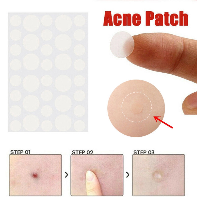 36pcs Patch Skin Care Face Pimple Remover Sticker Patch
